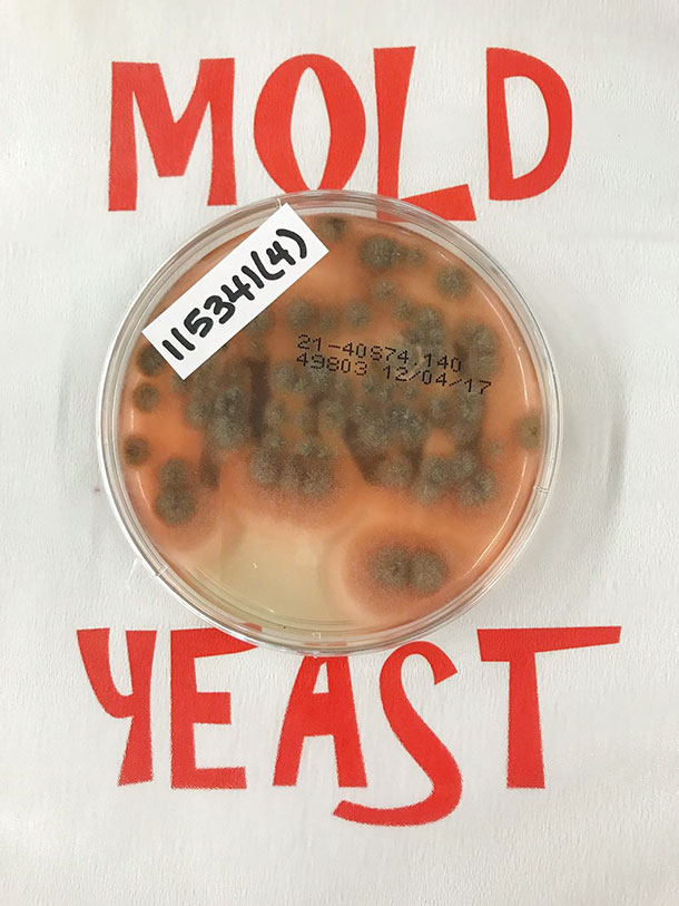mold and yeast