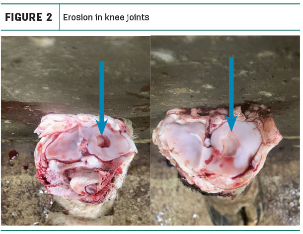 Erosion in knee joints
